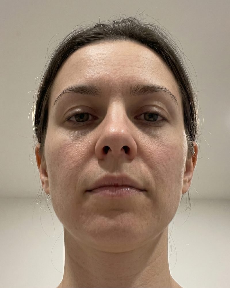 Avoid example input photo (AI-generated)